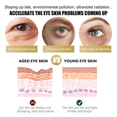 Retinol Eye Cream Stick Reduces Eye Bags, Dark Circles And Wrinkles, Moisturizes And Tightenes The Skin Around The Eyes