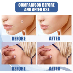 Kew Patch Gentle Cleaning Care Skin Face Neck Repair Smooth Skin Daily Care