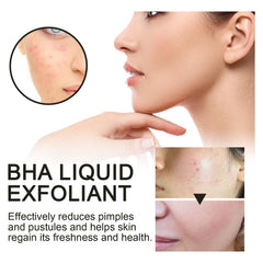 BHA Liquid Exfoliant, Lightening Acne Seal Pore-Tightening And Moisturizing Skin Essence
