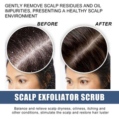 Scalp Exfoliating Scrub Moisturizes Dry Hair And Scalp Cleansing Treatment Refreshing Scrub