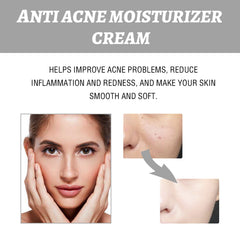 Hydrating Cream Hydrating And Lightening Facial Acne Repair Redness Hydrating And Brightening Moisturizing Cream