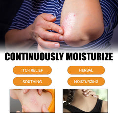 Bee Venom Psoriasis Care Spray, Soothing Skin Irritation Repair Moisturizing And Tender Skin Care Spray