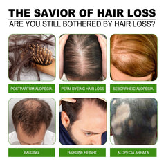 Hair Care Solution Gently Nourishes And Massages Scalp, Moisturizes And Softens Hair Care Spray