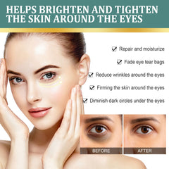 Light Dark Circles Eye Cream, Gentle And Moisturizing, Lightening Fine Lines, Tightening Eye Bags, And Anti-Aging Eye Cream Around The Eyes