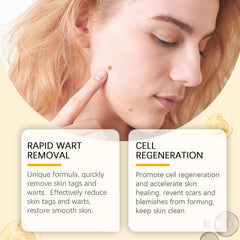 Keyu Care Cream, Gently Clean, Moisturize, Dilute Meat Granules, Repair And Smooth Skin Care Cream