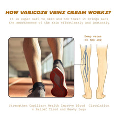 Vein Renewal Smooth Legs Cream, Relief Sore Legs Massage Varicose Earthworm Leg Vein Care Cream