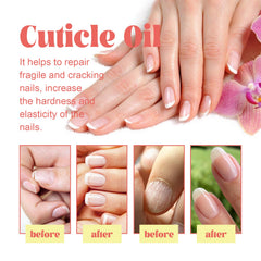 Cuticle Oil, Repair Dry Rotted Nails Thickening Moisturizing Care Brightening Nails And Cleaning