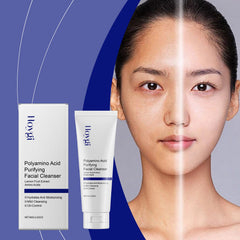 Acne Cleanser Gently Cleanses Pores And Clears Acne Refreshing And Non-Tight Moisturizing Moisturizing Cleanser
