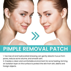 Acne Patch Repair Acne Patch Pore-Cleansing Invisible Breathable Concealer Waterproof Acne Patch