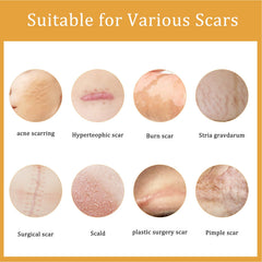 Desalting Skin Scar Cream, Skin Burn Scalding Surgical Scar Wound Repair Cream