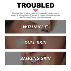 Retinol Eye Cream Stick Firming Fine Lines Repair Eye Skin Tender Skin Moisturizing Eye Cream Around Eye Care
