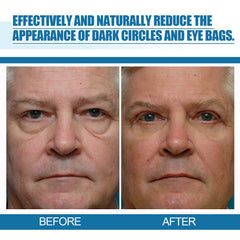 Men's Eye Serum Reduces Fine Lines, Bags, Dark Circles, Moisturizes, Firming, Brightening And Anti-Aging Eye Area