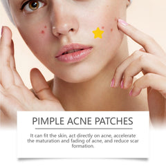 Facial Acne Patch, Repair Facial Acne Acne Facial Skin Care To Remove Facial Acne