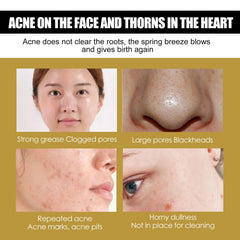 Advanced Snail 92 All In One Cream, Brightening And Firming Skin Face Cream With Moisturizing Moisturizing Moisture