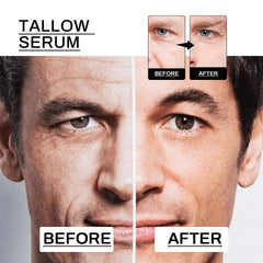 Anti-Wrinkle Serum For Men, Anti-Wrinkle Firming Skin Young Elastic Moisturizing Translucent Essence