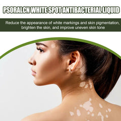 White Spot Purifying Serum For Whitening And Repairing White Spot Spot And Perspiration Spot Skin Moisturizing Serum