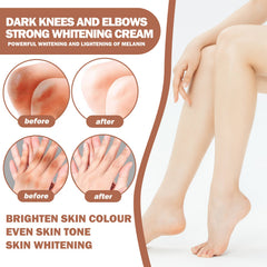 Joint Whitening Cream, Moisturizes Dull Skin Whitening Repair Cream For Joints And Elbows