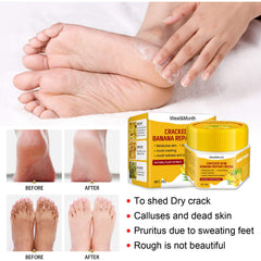 Cracked Skin Banana Repair Cream, Nourishing And Moisturizing Foot Repair Cream To Soften Exfoliation And Remove Dead Skin Calluses