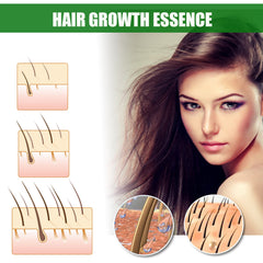 Ginger Hair Growth Spray, Nourishing And Nourishing Hair Root, Hair Care Solution To Prevent Scalp Loss