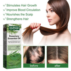 Rosemary Hair Dense Essential Oil, Prevent Hair Breakage And Hair Loss Strong, Strong And Solid Hair Moisturizing Root Dense Essential Oil