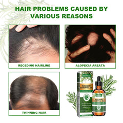 Rosemary Essential Oil Hydrates And Moisturizes Damaged Hair, Strengthens Hair And Softens Hair Care Essential Oil