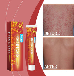 Skin Care Cream, A Gentle Formula To Moisturize Dry Skin