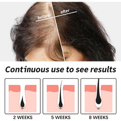 Hair Essence, Repair Dry Hair, Moisturize Hair Roots And Scalp Hair Essence