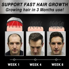 Moving Hair Growth Treatment, Repair Frizzy, Smooth And Dense Hair Scalp Care Heating Massage Cap