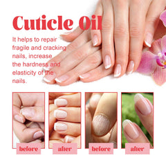 Cuticle Oil, Manicure Bed Moisturizes And Brightens Nails Anti-Barb And Removes Dead Skin Fingeredge Oil