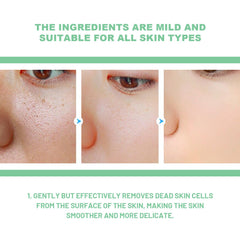 Exfoliating Gel, Mildly Clean Silent Black Mouth Contractive Pore Chamfer Bright Skin Gel