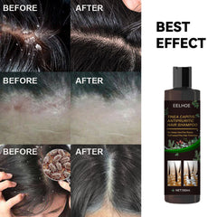 Tinea Capitis Anti-Itch Shampoo Anti-Drop Refreshing Oil Control Hair Care Anti-Dandruff Anti-Itch Shampoo