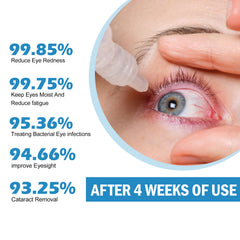 Eye Drops Dryness Soothing, Relieve Eye Fatigue, Dry Eyes, Red Eyes, Blurred Vision Eyes Care Lotion