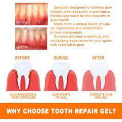 Tooth Repair Essence, Cleaning Teeth Stains Tartar Care Gums Oral Care Essence