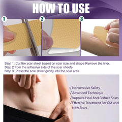Silicone Scar Patch, Reduces Stretch Marks And Hyperplasia Of Caesarean Section Scars Silicone Patch