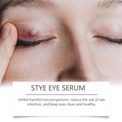 Eye Care Solution, A Gentle Moisturizing Eye Solution That Relieves Acidness, Is A Daily Portable Eye Care Drops