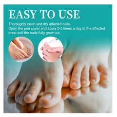 Nail Repair Pen, Repair Hands And Feet Gray Nails Brightening Nails Soft Nails Thickening Nails Moisturizing Care