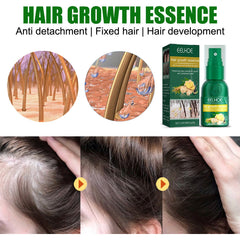 Ginger Hair Growth Spray, Nourishing And Nourishing Hair Root, Hair Care Solution To Prevent Scalp Loss