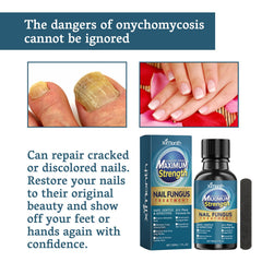 Nail Fungus Treatment, Nail Thickening Of Embedded Light Mail This Soft Armour Brothers Nails Detailer