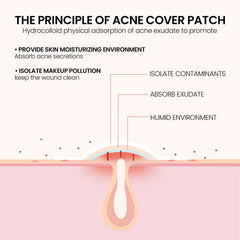 Pimples Patch, Mild Non-Irritant Lightening Pimples Spot Pimples Mark Covering Acne Pimples Patch