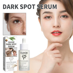 Dark Spot Serum, Fade Spot Moisturize Skin Repair Blain Mark Face Dull Shine Essence