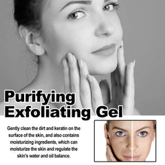 Purifying Exfoliating Gel, Chun White Tender Skin Clean Bright Skin Cutin Tighten Pores