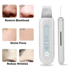 HailiCare New Ultrasonic Peeling Machine Pore Cleaner Horny Blackhead