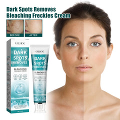 Whitening Spot Cream Hydrates And Moisturizes Skin To Lighten Spots, Acne Whitening, Brightening And Rejuvenating Skin Beauty Cream