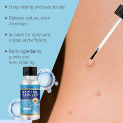 Keyu Liquid Hand And Foot Skin Especially Moles Cleansing Repair Smooth Skin Skin Label Care Liquid