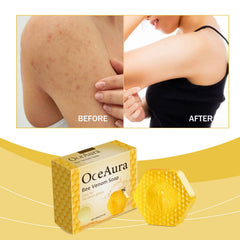 Oceaura Bee Venom Soap For Deep Body Cleansing, Moisturizing, Brightening And Improving Skin And Bathing Body Soap