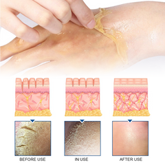 Exfoliating Hand Mask Moisturizes And Moisturizes Tender Skin, Alleviates Dry, Rough And Chapped Hands