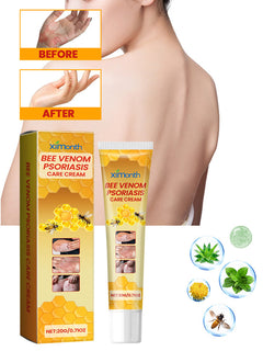 Bee-Poison Cowhide Moss Cream, Which Relieves Redness And Itchiness Of Skin