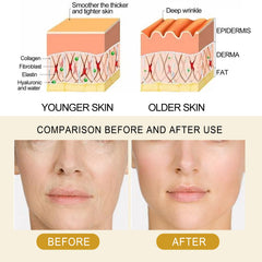 Collagen Essence Improves Facial Skin, Reduces Fine Lines, Hydrates And Firming Skin Essence