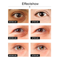 Snake Venom Eye Cream, Firming Eye Bags Hydrating And Reducing Fine Lines Eye Care Eye Cream