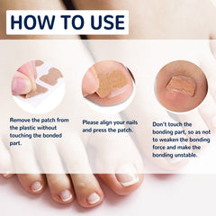 EELHOE toe nail correction patch